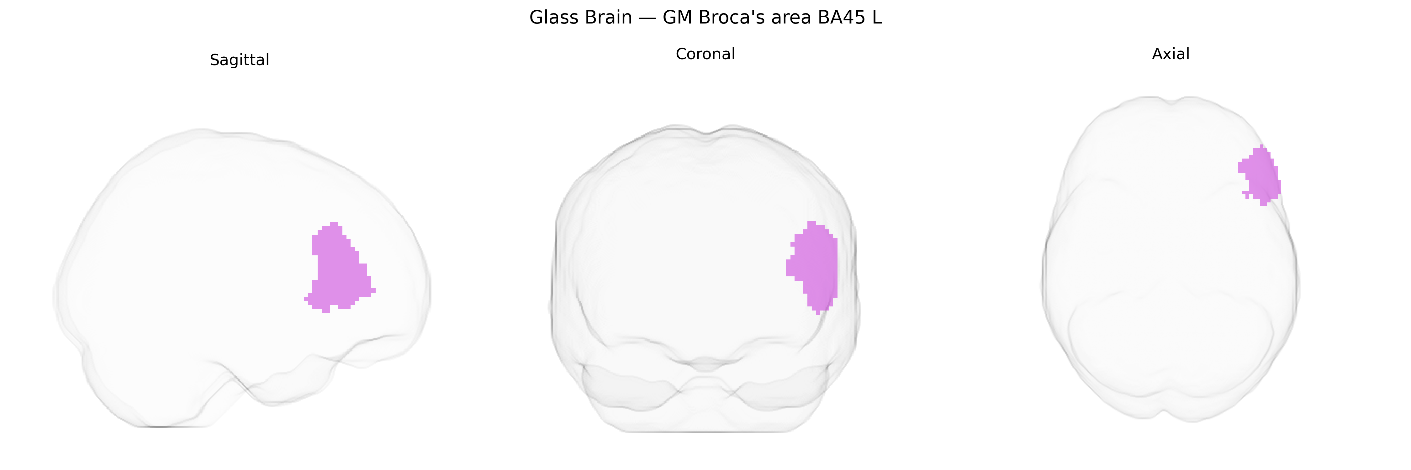 Triplanar Ghost Brain