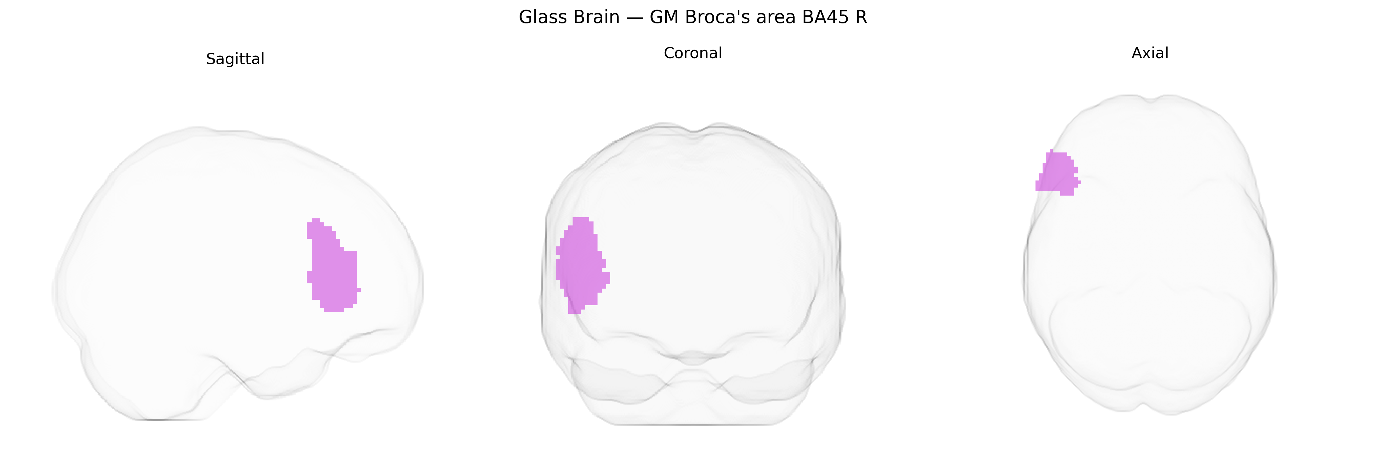 Triplanar Ghost Brain