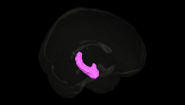 Full Brain Black