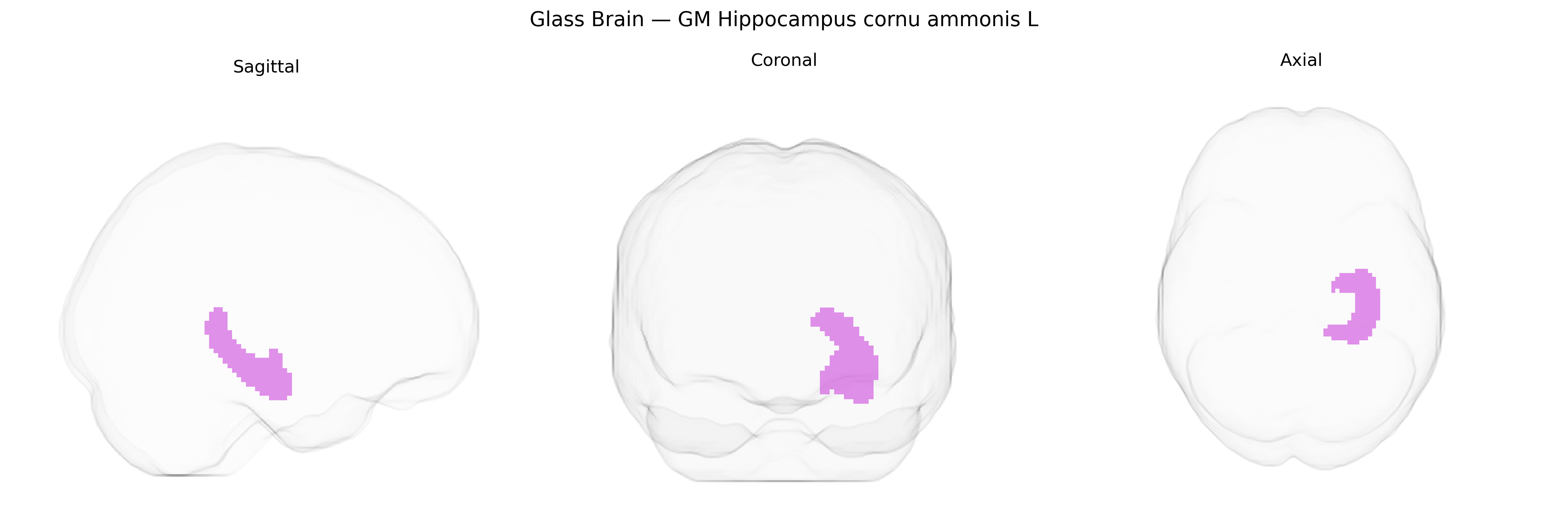 Triplanar Ghost Brain