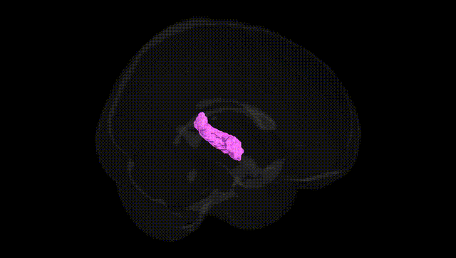 Full Brain Black
