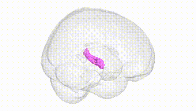 Full Brain White