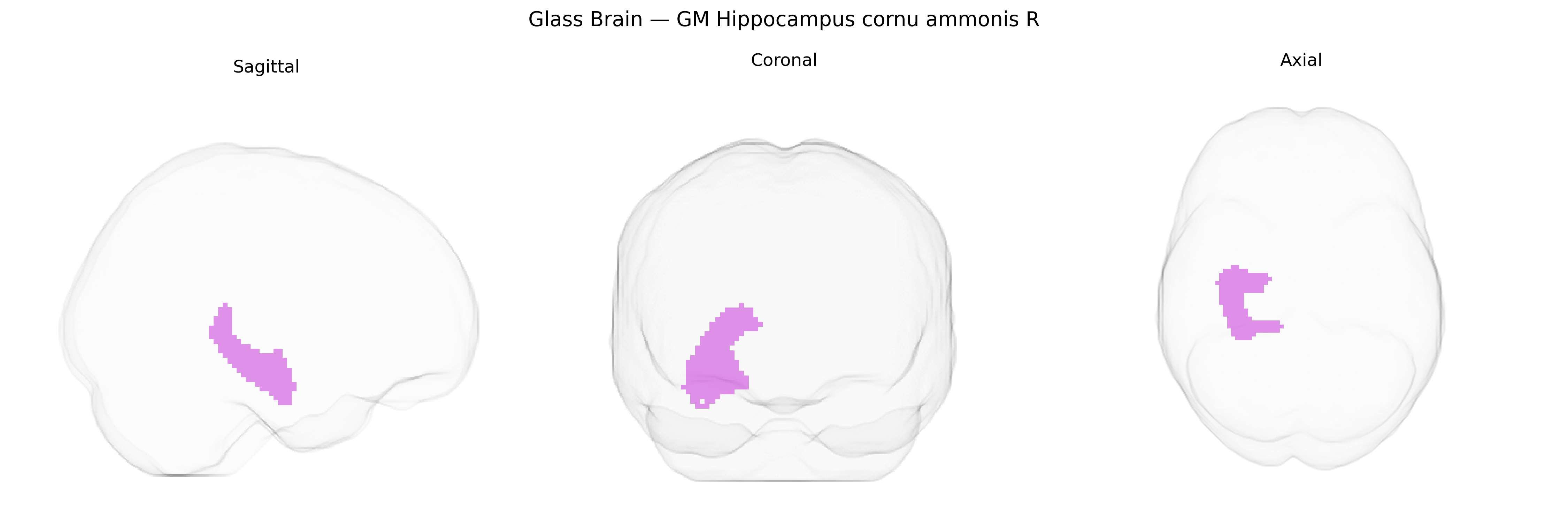 Triplanar Ghost Brain