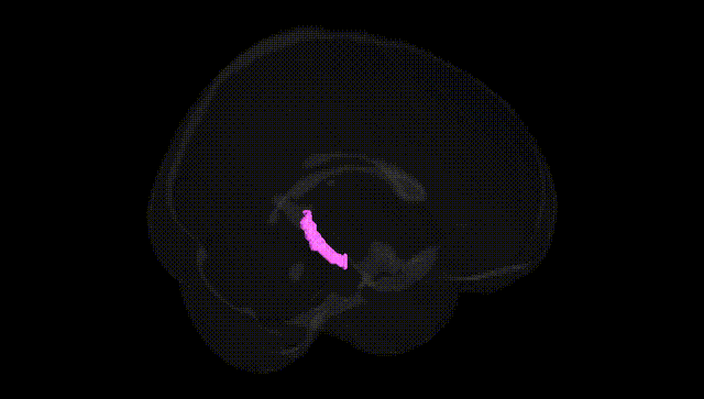 Full Brain Black