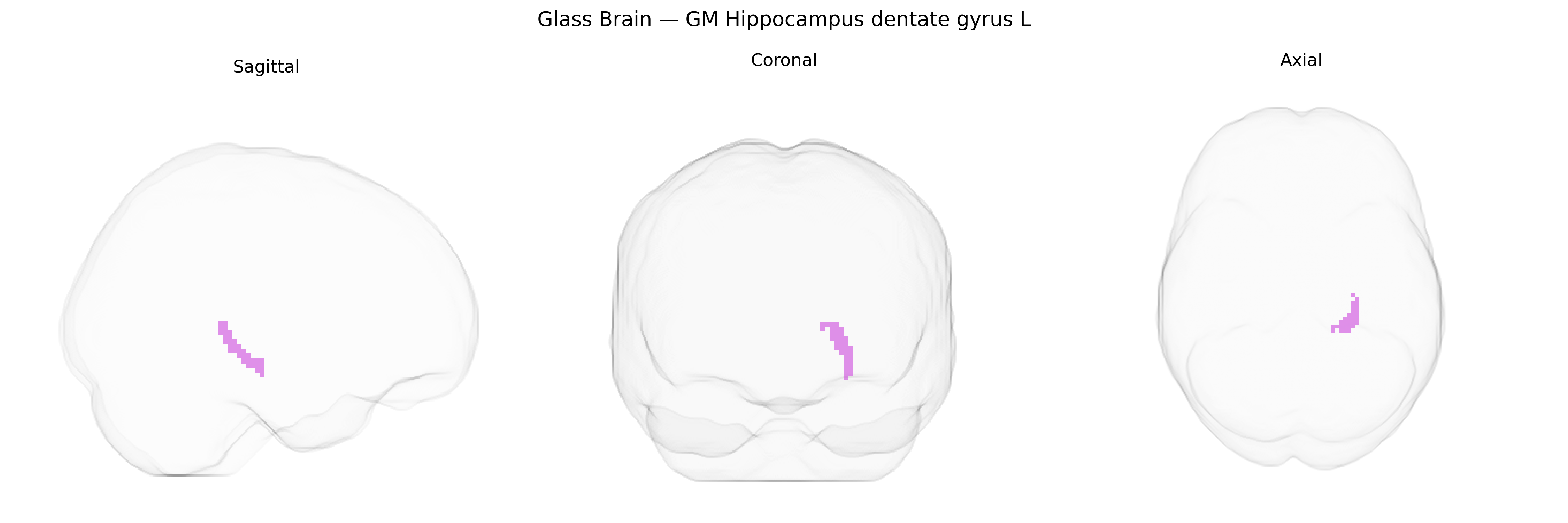 Triplanar Ghost Brain