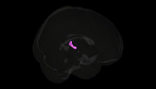Full Brain Black
