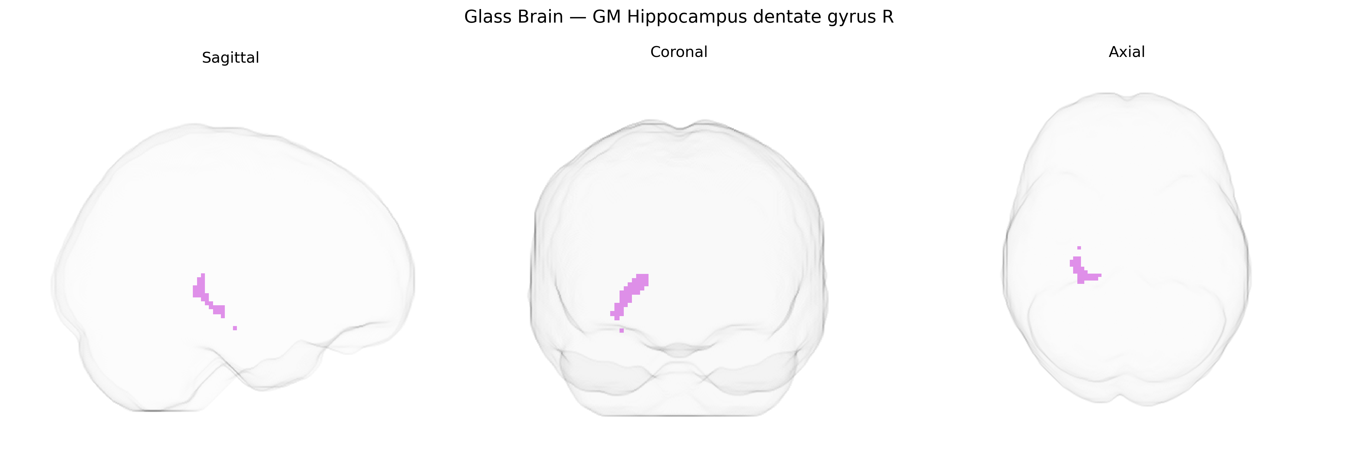 Triplanar Ghost Brain