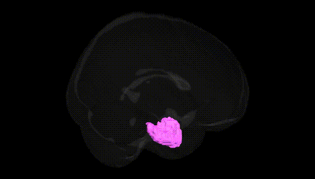 Full Brain Black