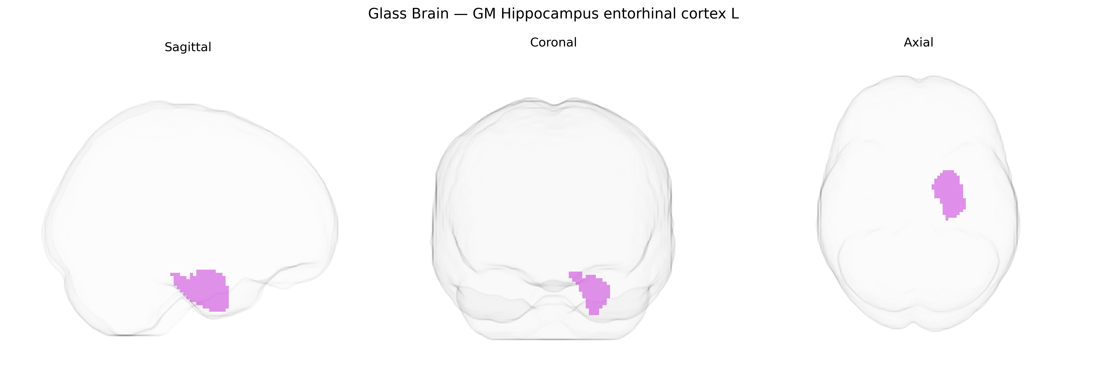 Triplanar Ghost Brain