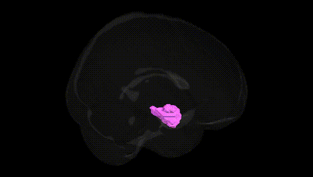 Full Brain Black