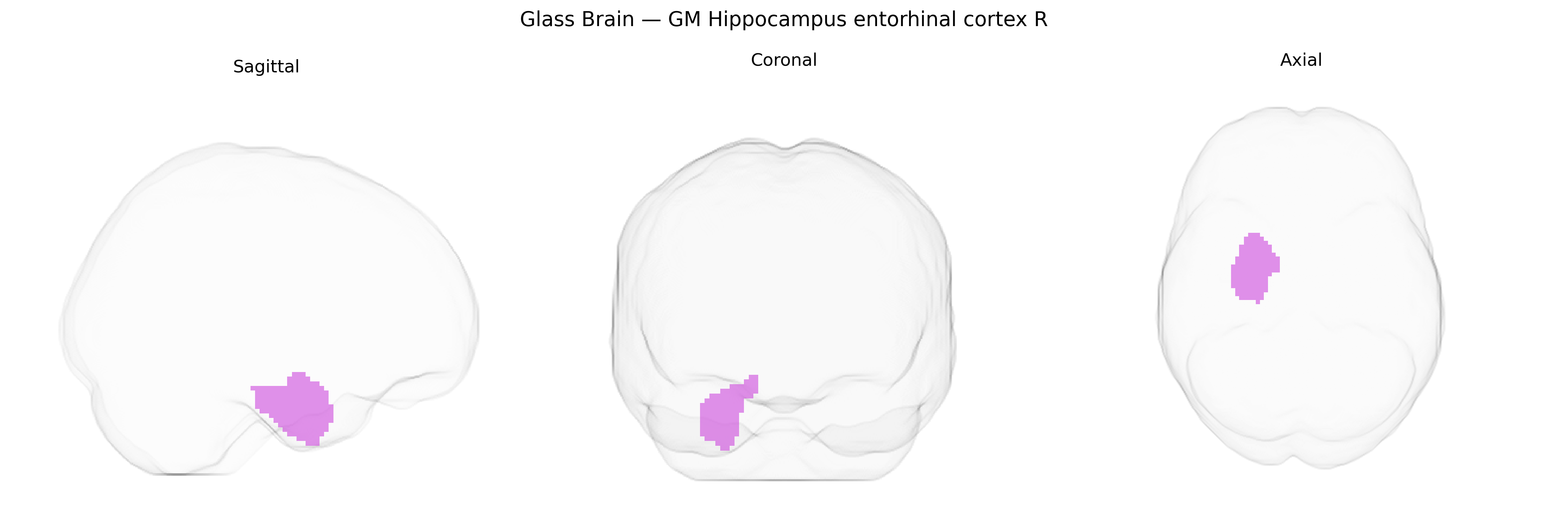 Triplanar Ghost Brain
