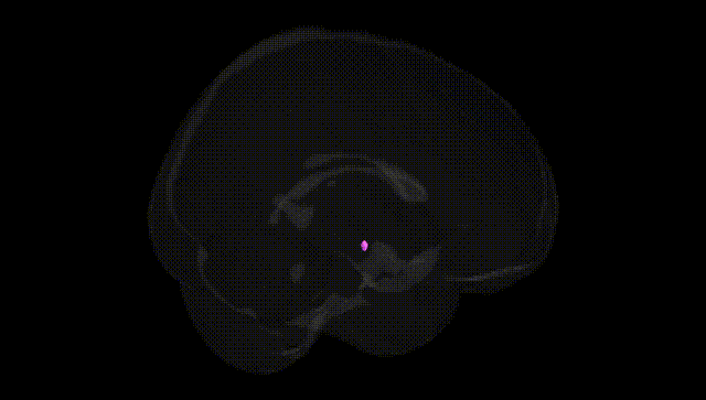 Full Brain Black