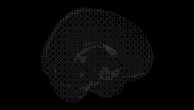 Full Brain Black