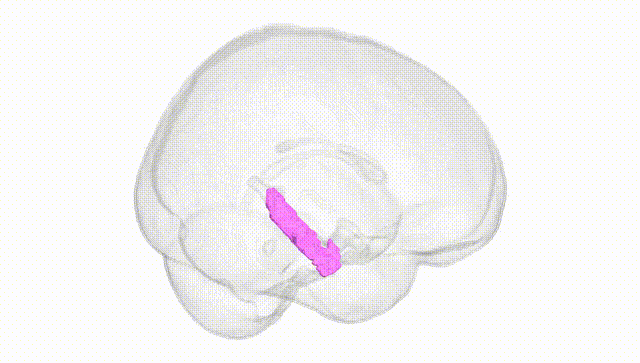 Full Brain White
