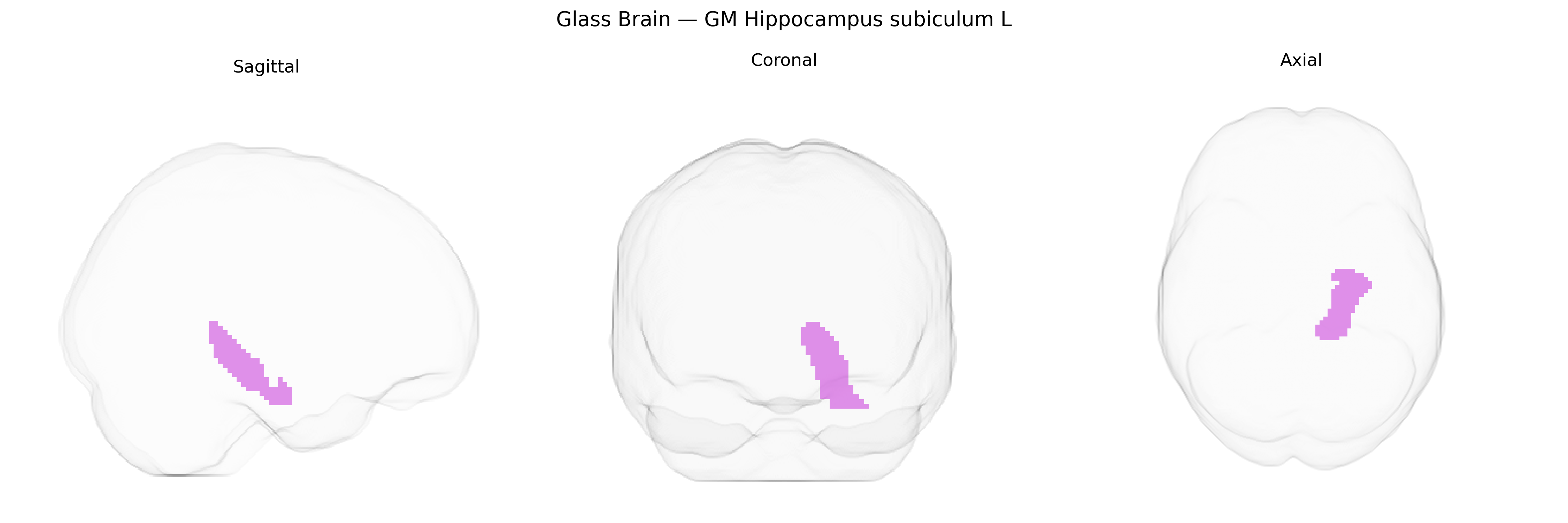 Triplanar Ghost Brain