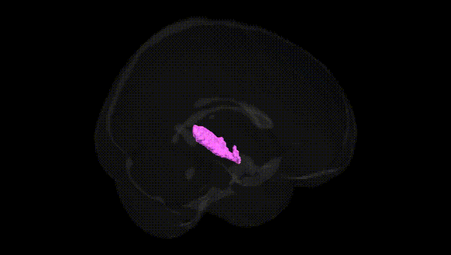 Full Brain Black
