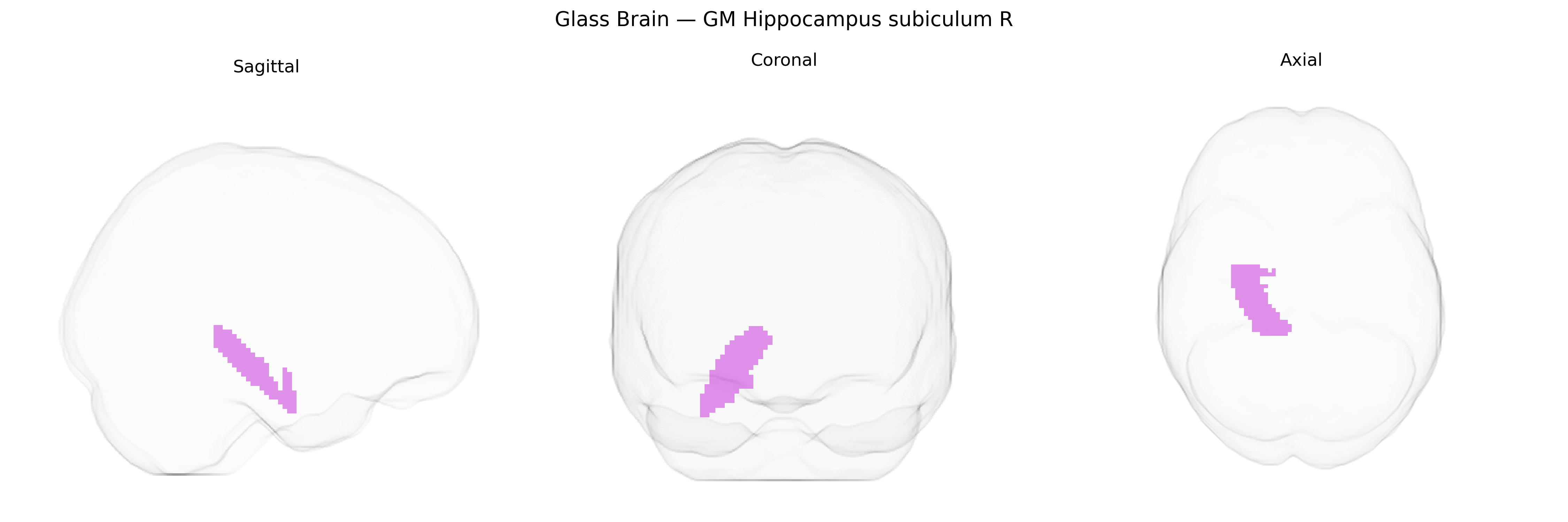 Triplanar Ghost Brain