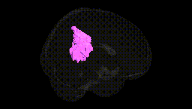 Full Brain Black