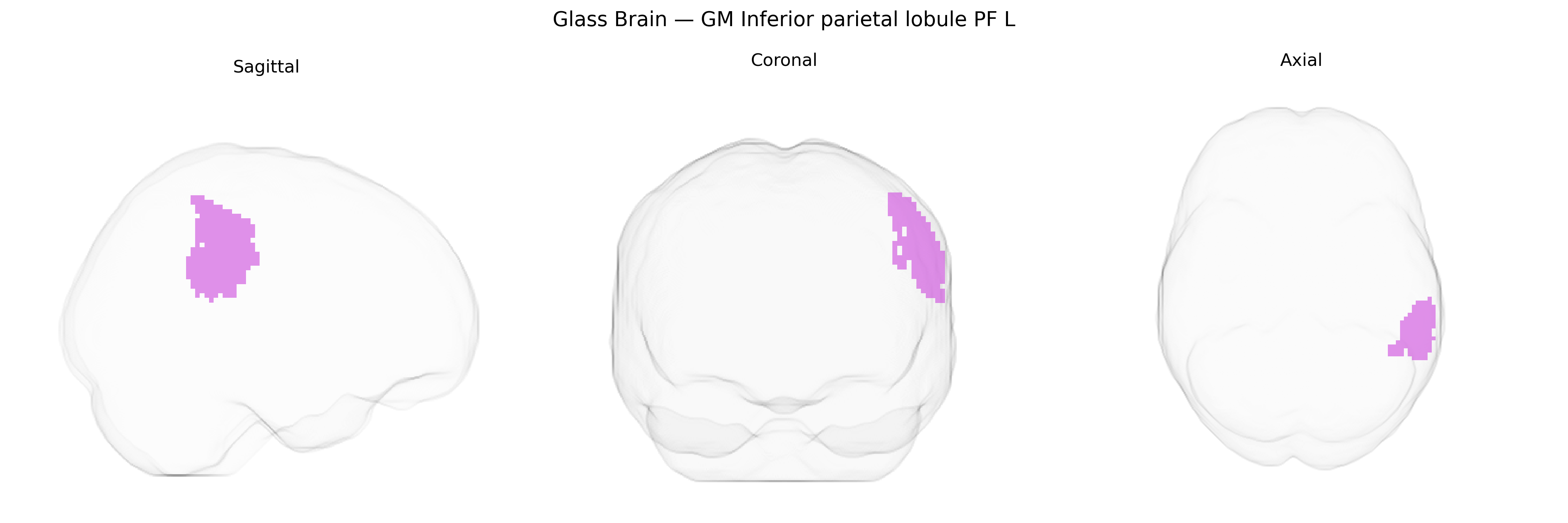 Triplanar Ghost Brain