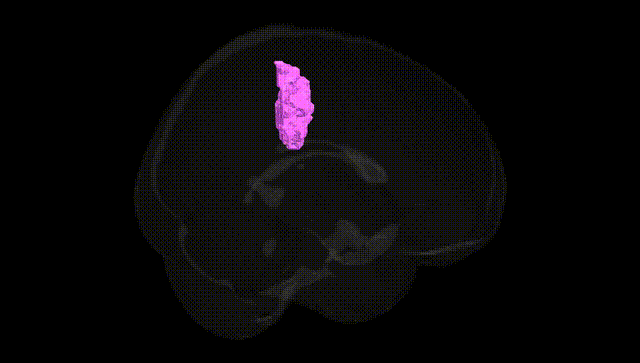 Full Brain Black