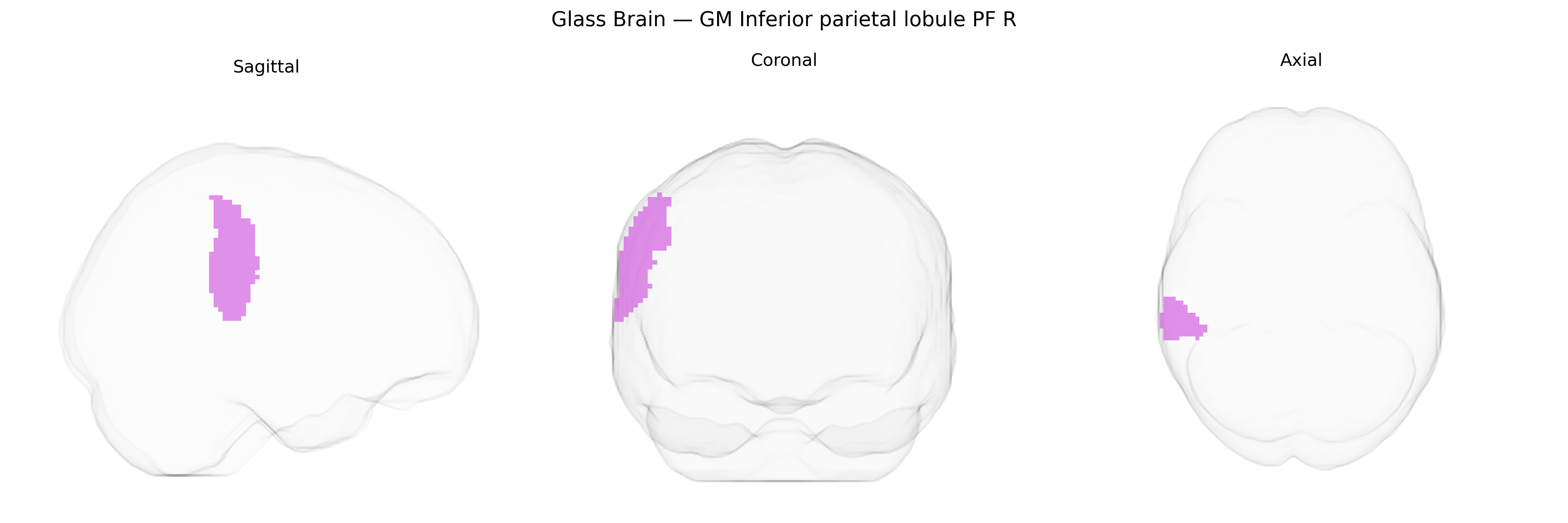Triplanar Ghost Brain