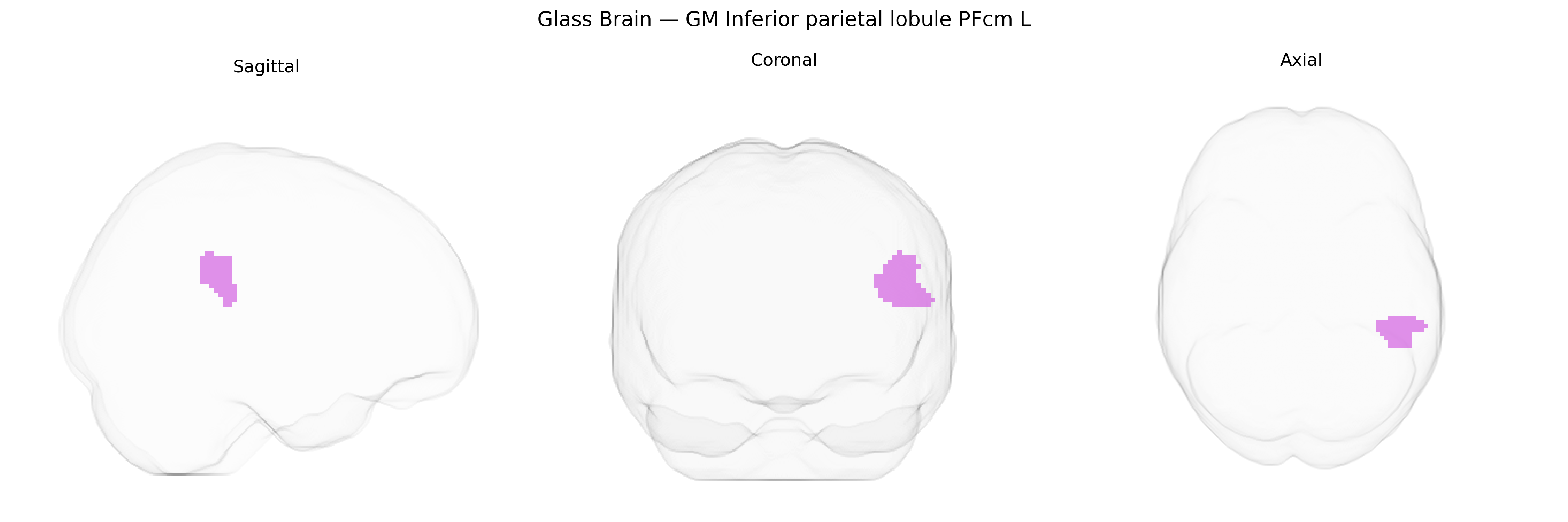 Triplanar Ghost Brain