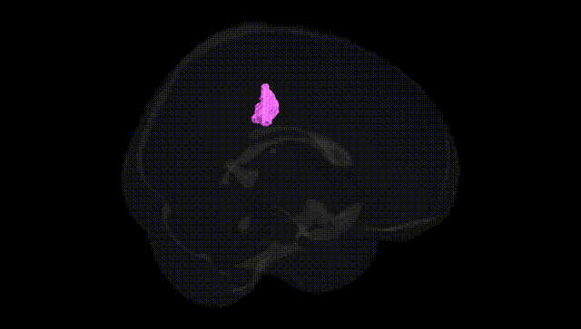 Full Brain Black