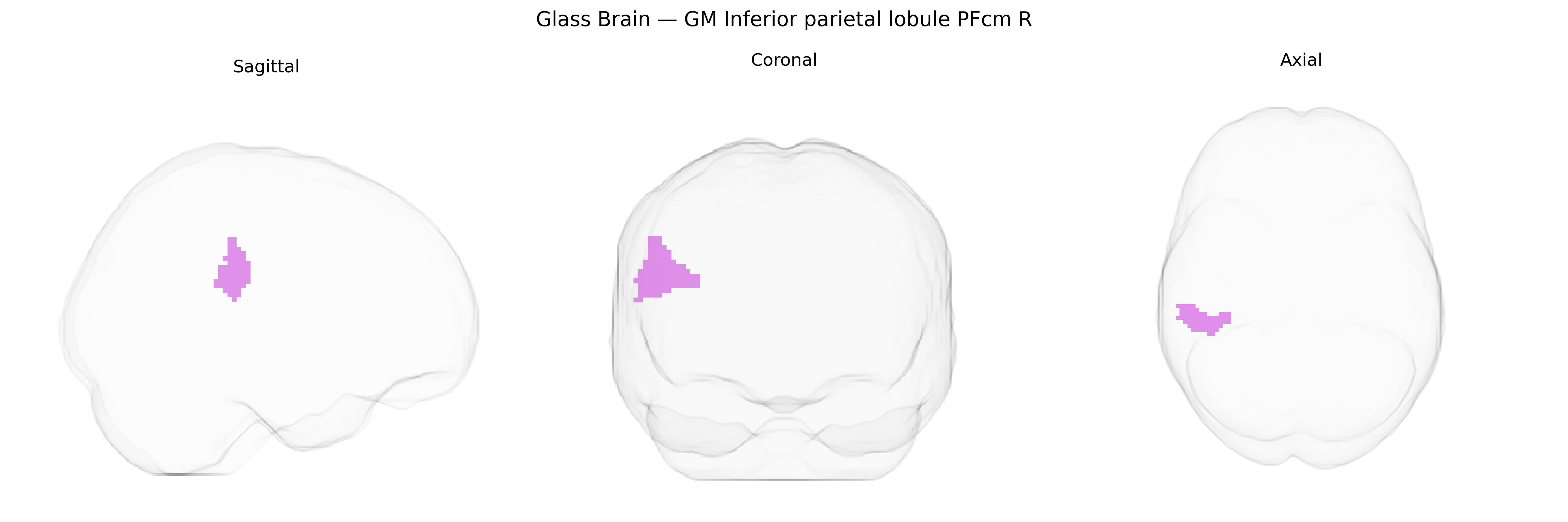 Triplanar Ghost Brain