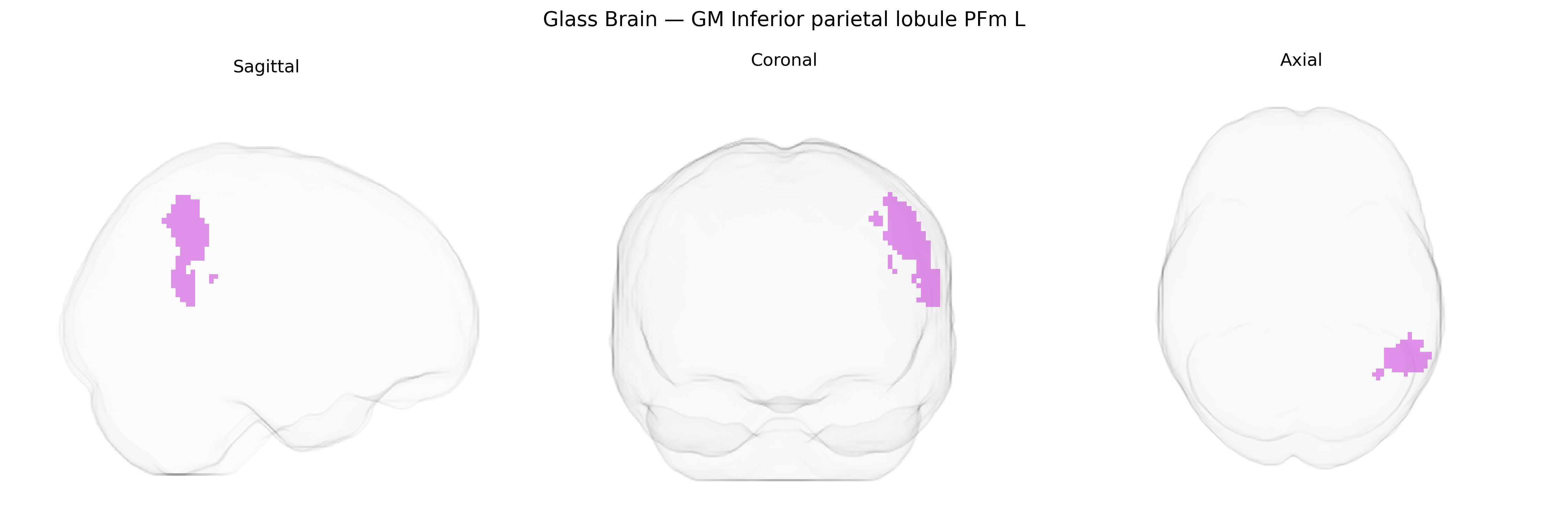 Triplanar Ghost Brain