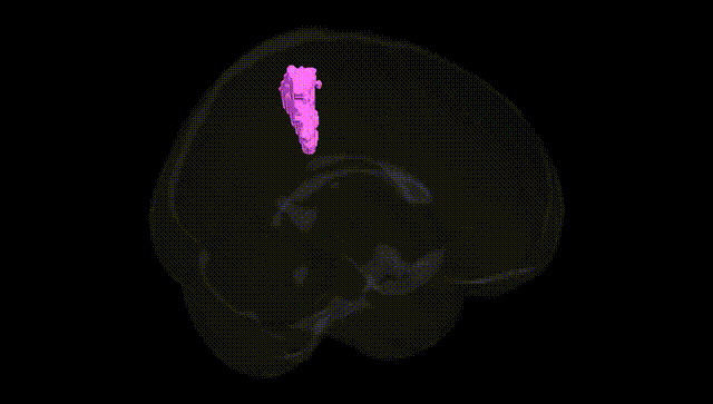 Full Brain Black