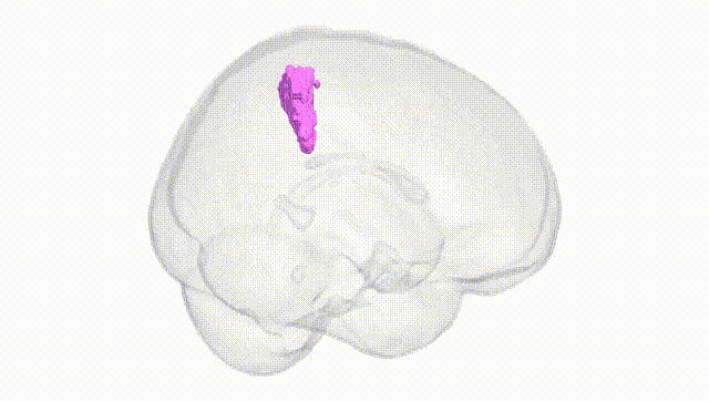 Full Brain White