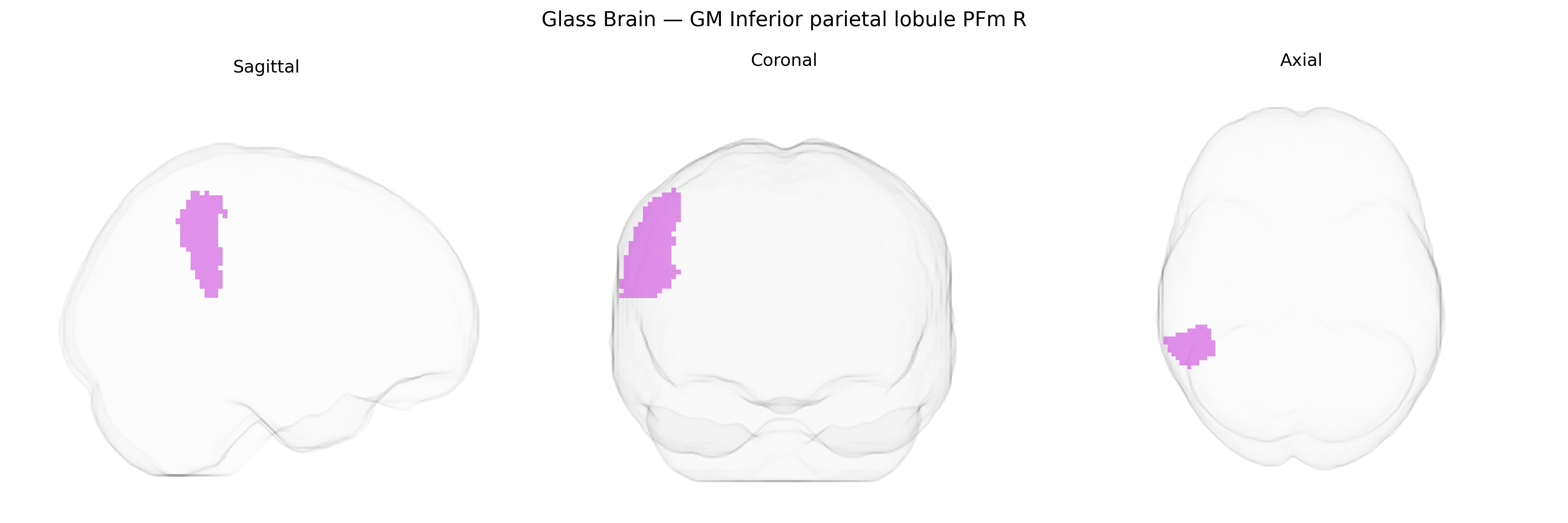 Triplanar Ghost Brain