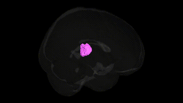 Full Brain Black