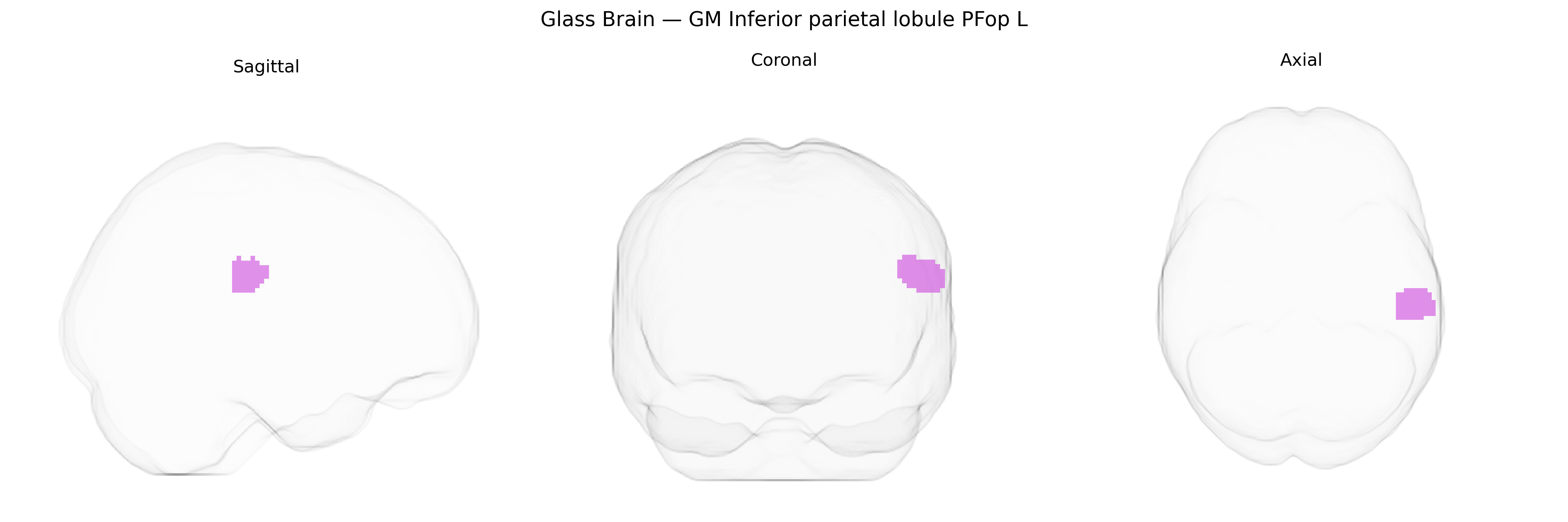 Triplanar Ghost Brain