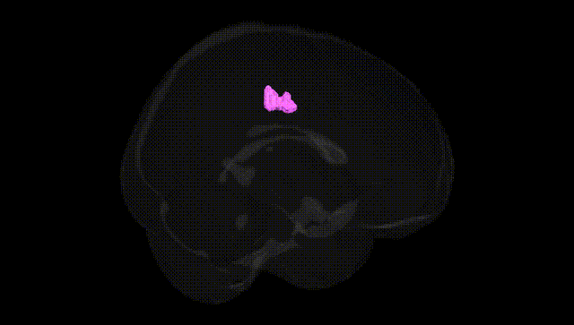 Full Brain Black