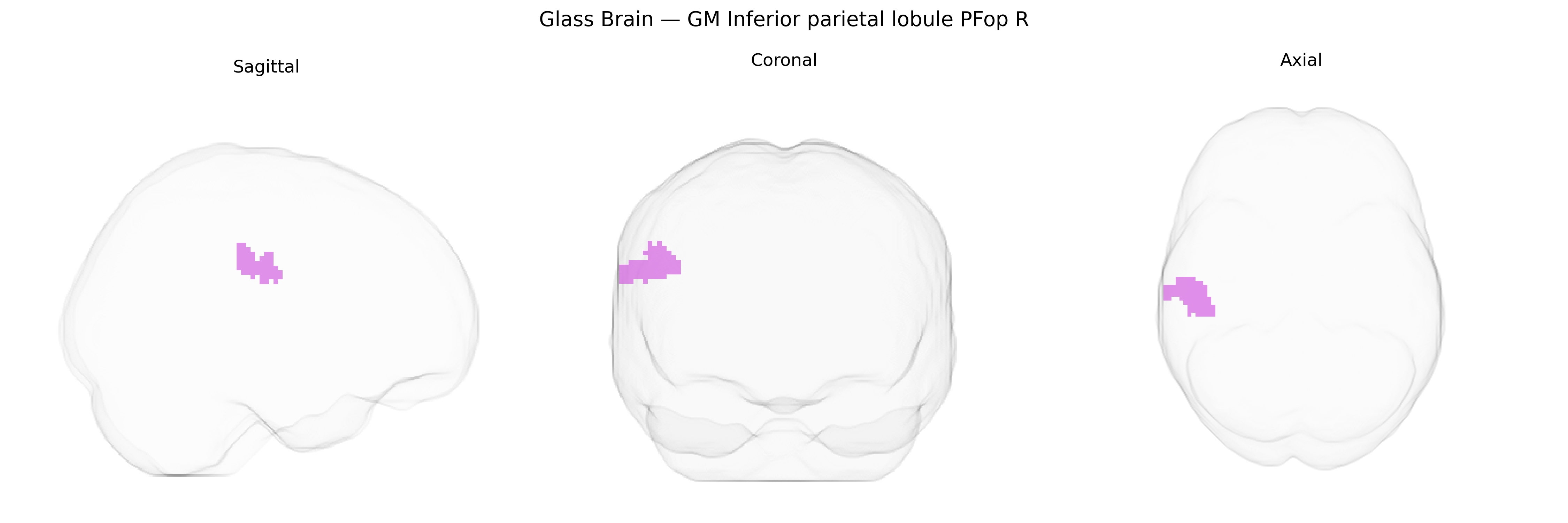 Triplanar Ghost Brain