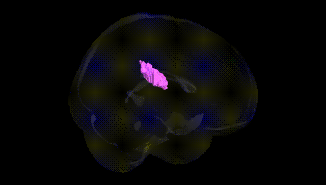 Full Brain Black