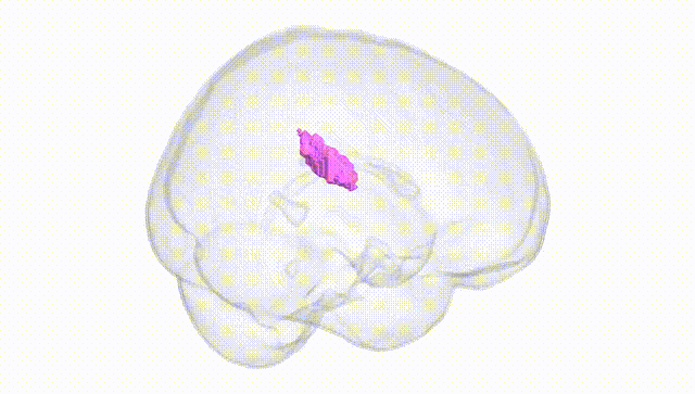 Full Brain White