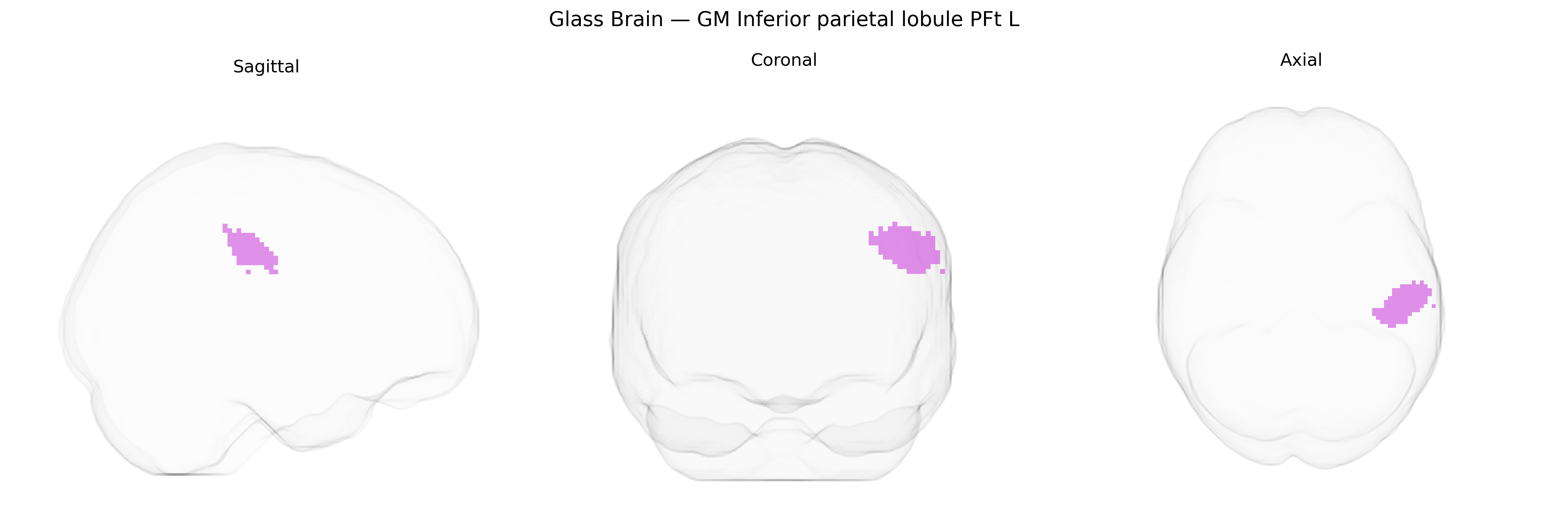 Triplanar Ghost Brain