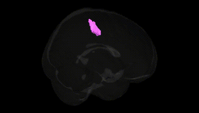 Full Brain Black