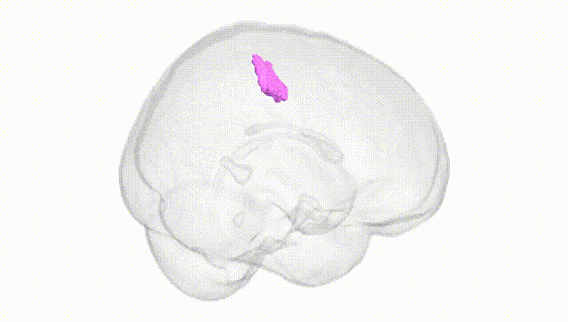 Full Brain White