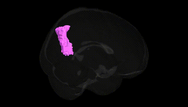 Full Brain Black