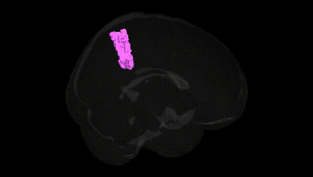 Full Brain Black