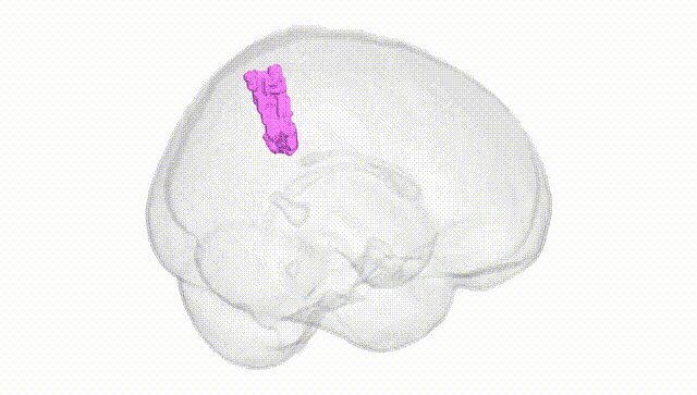 Full Brain White