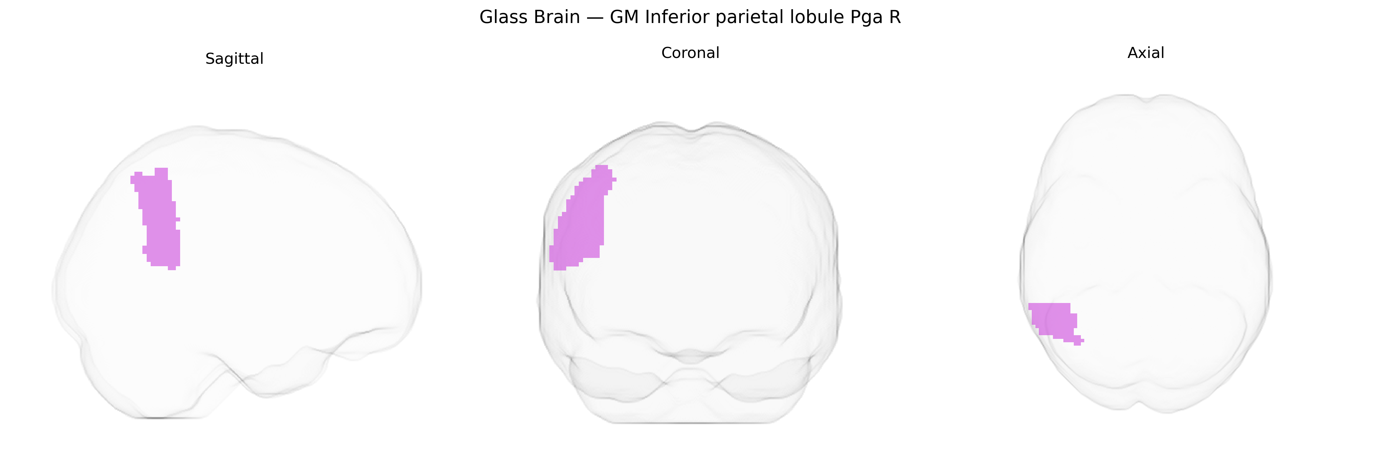 Triplanar Ghost Brain
