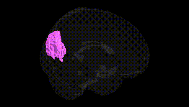 Full Brain Black