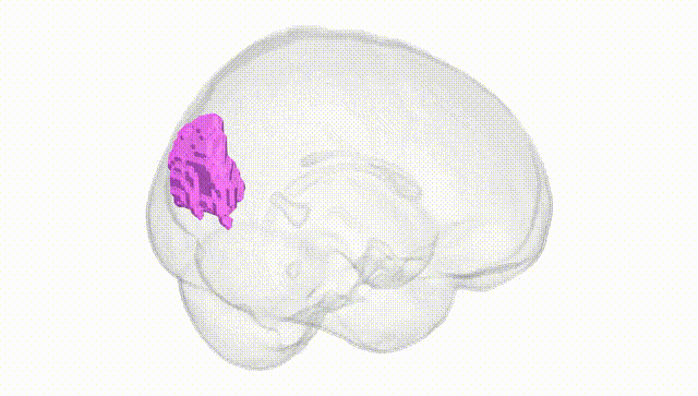 Full Brain White