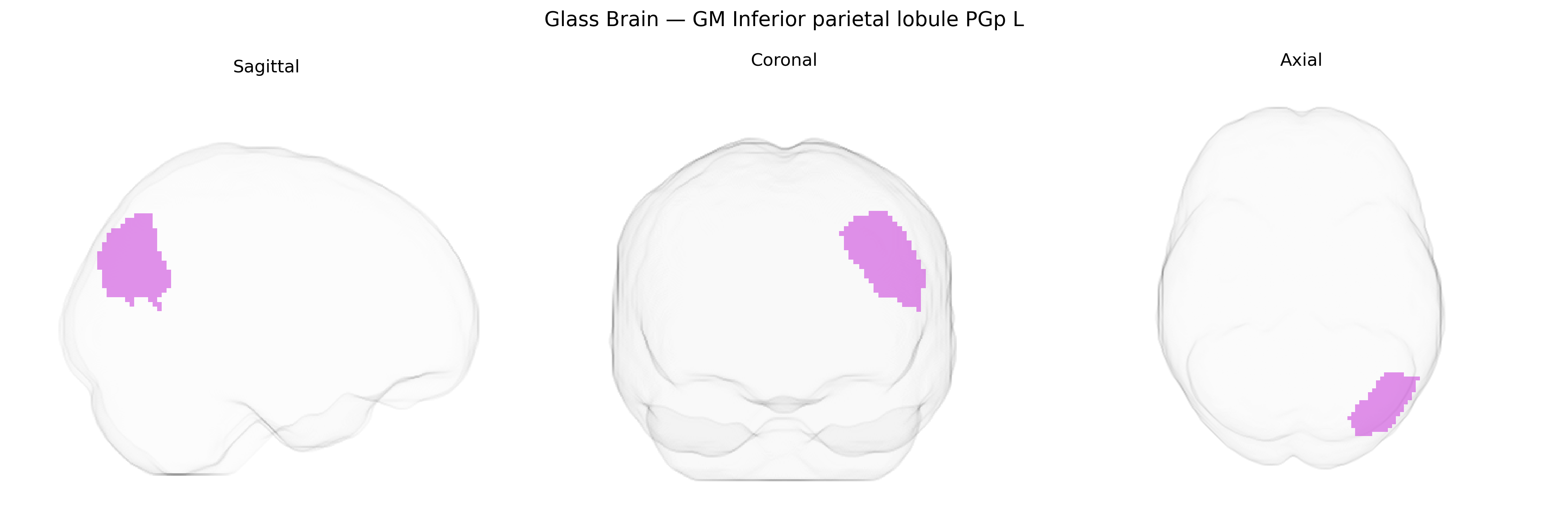 Triplanar Ghost Brain