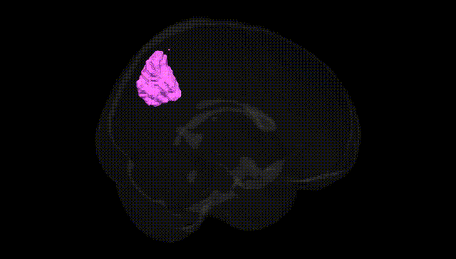 Full Brain Black