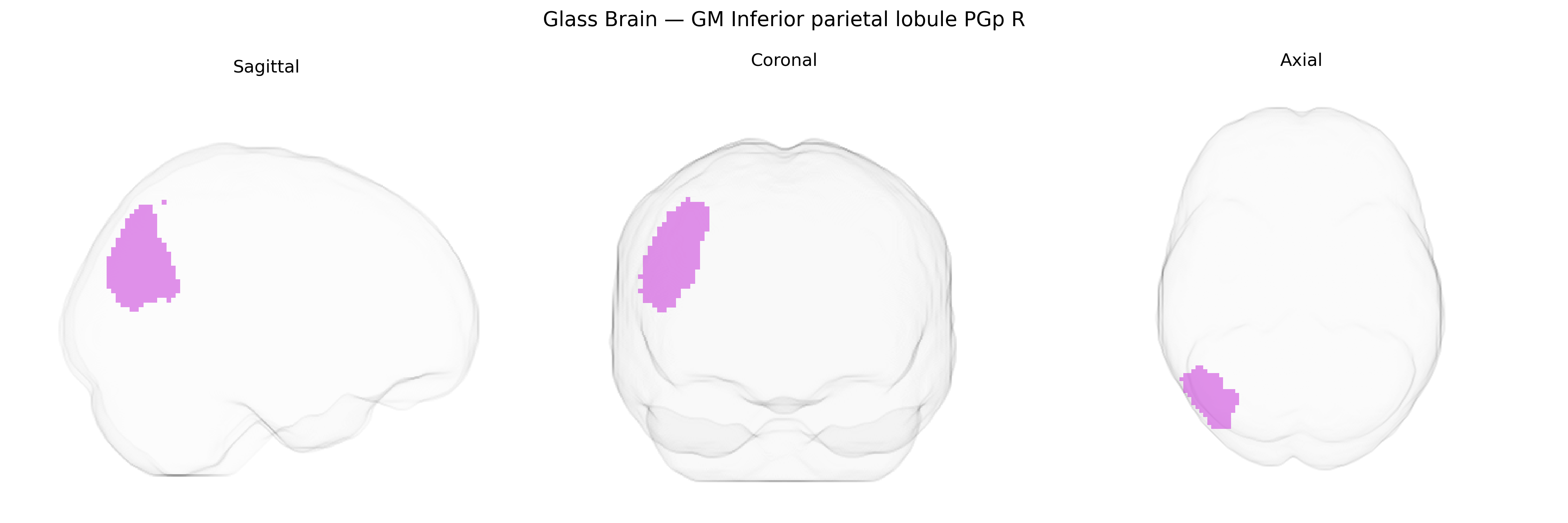 Triplanar Ghost Brain